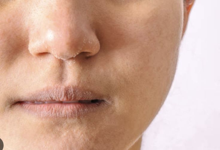 Kulit Selalu Terkena Paparan AC hingga Kering? Ini 9 Cara Mengatasinya!