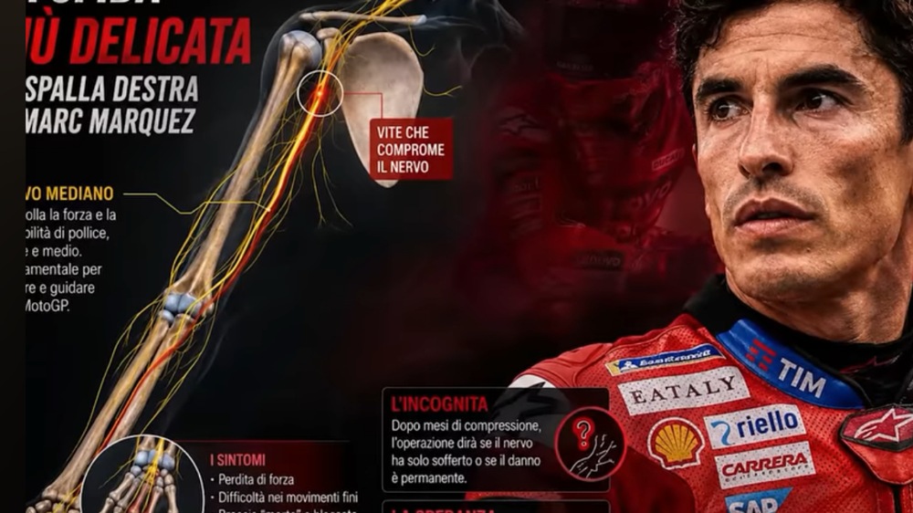 Cedera Marc Marquez Ternyata Mengerikan, Saraf Terjepit dan Risiko Permanen Bikin Ducati Cemas
