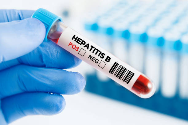 28 Juli Hari Hepatitis Sedunia, Penyakit yang Bisa Diam-Diam Mengancam