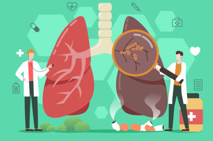 Hari Kesehatan Paru-Paru 2025: Saatnya Jaga Napas Tetap Sehat di Tengah Polusi