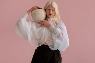 13 Juni, Momentum Global Mengangkat Suara Penyandang Albinisme