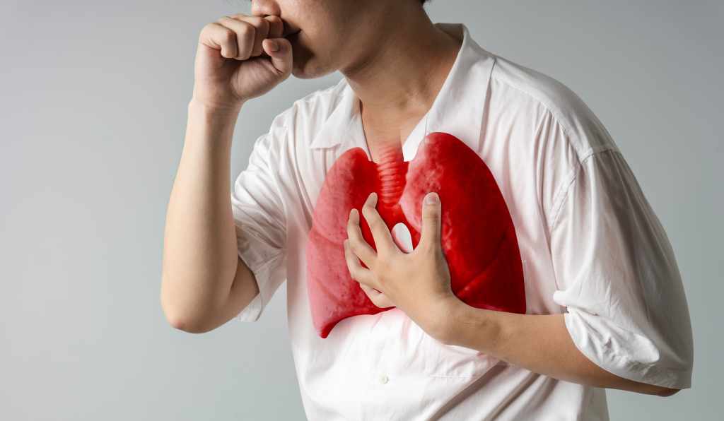 TBC Tembus 1 Juta Kasus di Indonesia, Selain Vaksin Bill Gates, Ini Strategi Nasional Penanggulangannya