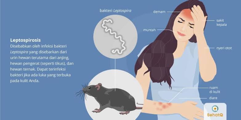 Hujan Masih Sering Turun, Waspada Leptospirosis! Kenali Gejala Penyakit Kencing Tikus Ini