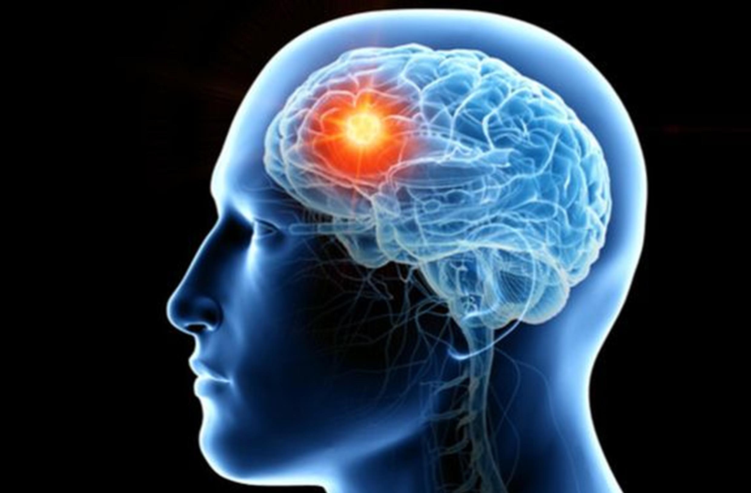 9 Penyebab Pikun dan Cara Mencegahnya