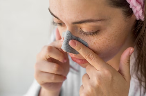 Komedo di Hidung Membandel? Yuk Intip Cara Menghilangkan Komedo Hidung