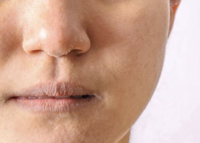 Kulit Selalu Terkena Paparan AC hingga Kering? Ini 9 Cara Mengatasinya!