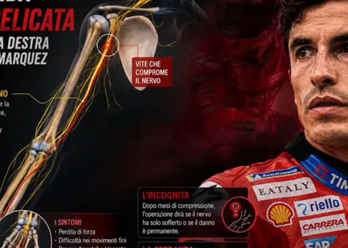 Cedera Marc Marquez Ternyata Mengerikan, Saraf Terjepit dan Risiko Permanen Bikin Ducati Cemas
