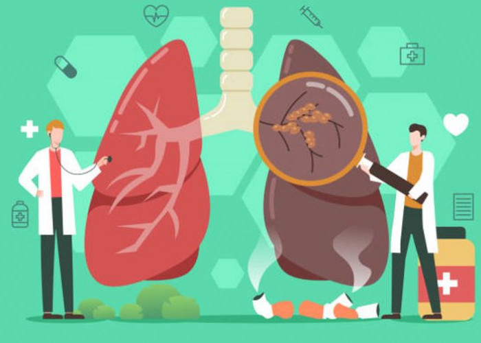 Hari Kesehatan Paru-Paru 2025: Saatnya Jaga Napas Tetap Sehat di Tengah Polusi