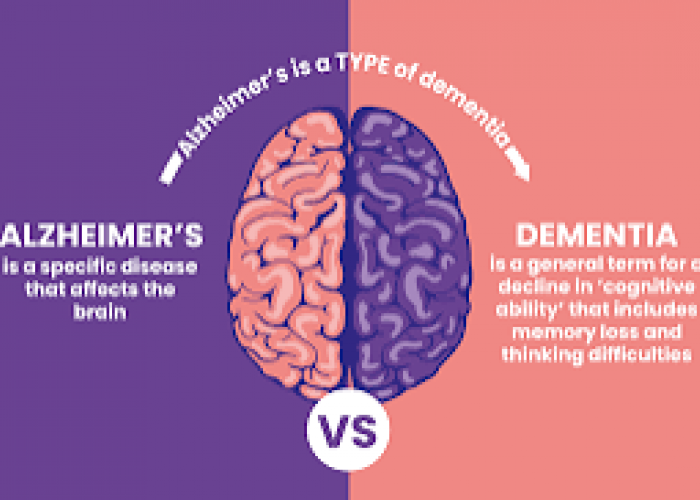 Demensia dan Alzheimer Sering Dianggap Sama, Ternyata Berbeda! Ini Penjelasan Medisnya