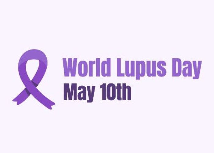10 Mei Lupus Day, Ini 9 Tanda Awal Lupus dan Mitosnya, Jangan Sepelekan Ya!