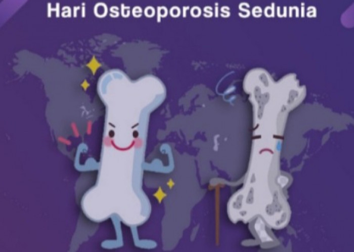 Hari Osteoporosis Sedunia 2026: Sejarah, Tema, dan Temuan Penelitian di Malang