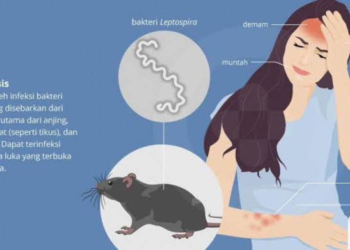 Hujan Masih Sering Turun, Waspada Leptospirosis! Kenali Gejala Penyakit Kencing Tikus Ini