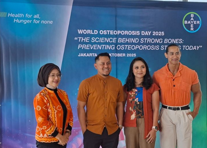 Data Mengejutkan Kemenkes: Patah Tulang Dipicu Osteoporosis Melonjak Drastis pada Wanita Lanjut Usia