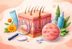 Kenali 9 Jenis Penyakit Kulit yang Umum Terjadi: Gejala Mirip, Penyebab dan Penanganan Berbeda