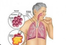 Tuntaskan TBC, Dinkes Kota Batu Gandeng Baznas, agar Kover Uang Nafkah selama Kepala Rumah Tangga Berobat