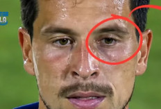 Thom Haye dan Mata Lebam Usai Keributan, Ini yang Sebenarnya Terjadi